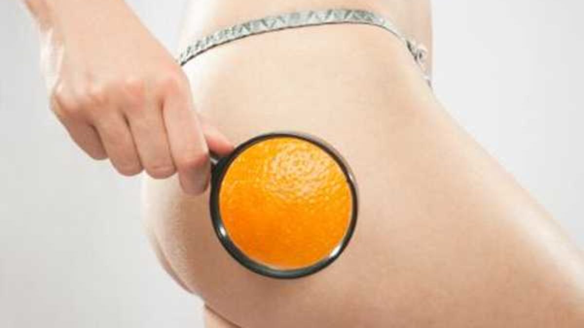 L'incubo delle donne: la cellulite! Cosa possiamo fare?